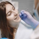 What Are Self Ligating Braces And How Do They Work?